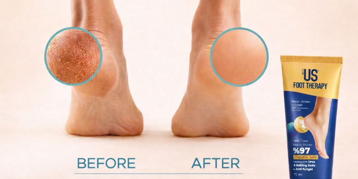 کرم ترک پای ویت‌آس