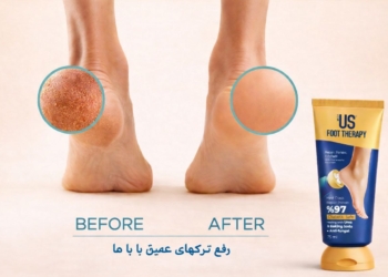 کرم ترک پای ویت‌آس